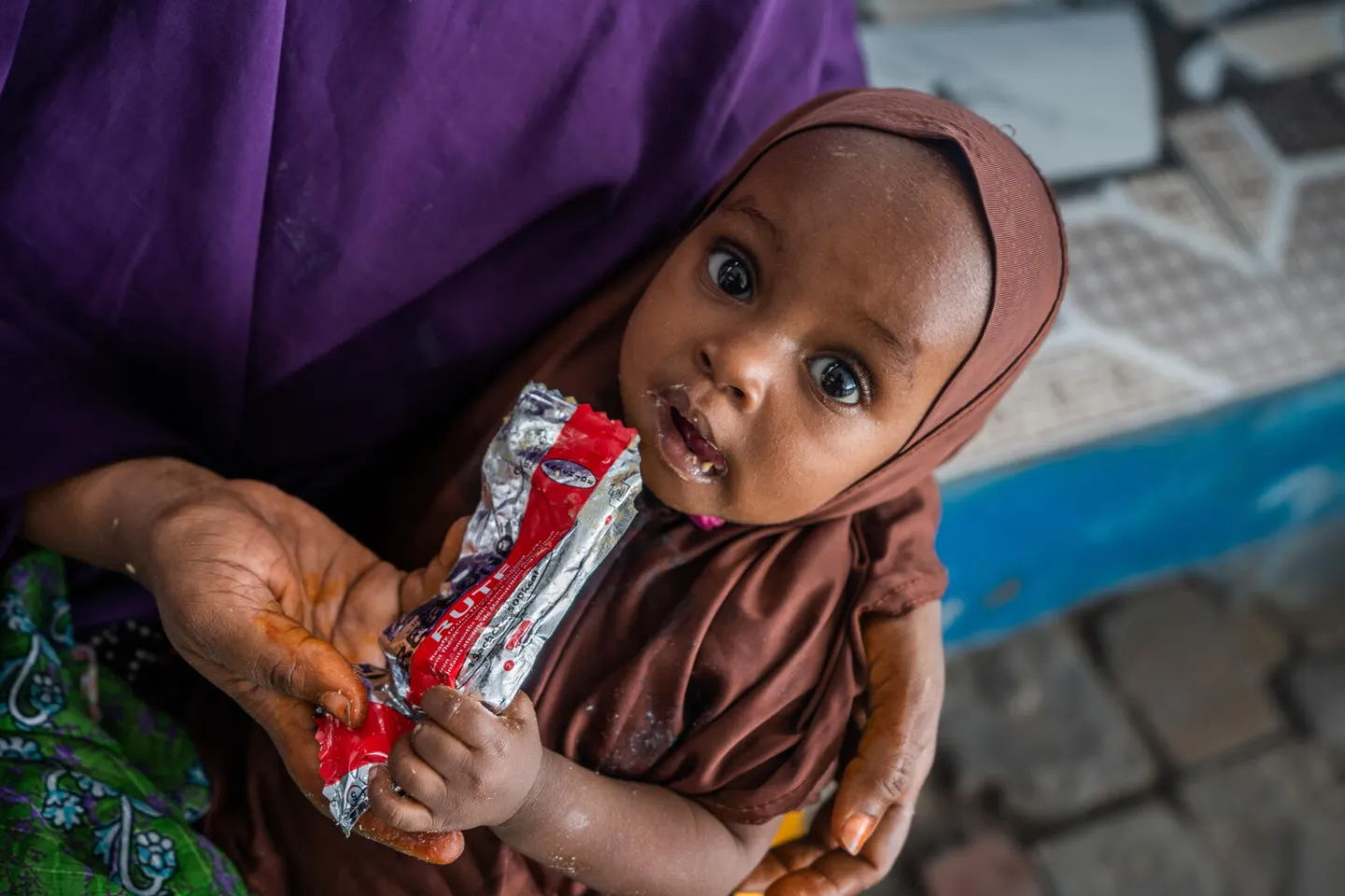 A Somali child eats Ready-to-Use Therapeutic Food (RUTF) after being screened for malnutrition.