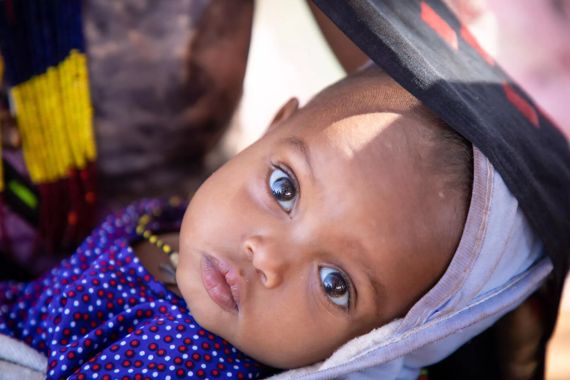 Ethiopia. A woman holds her child, who is being screened for malnutrition.