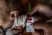 Pakistan. A child's arm is measured with tape as part of a screening for malnutrition.