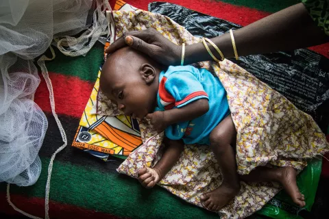 A woman caresses the head of her sleeping malnourished baby, at the mother and child centre in the town of Diffa, in the Diffa region on 20 February 2017.