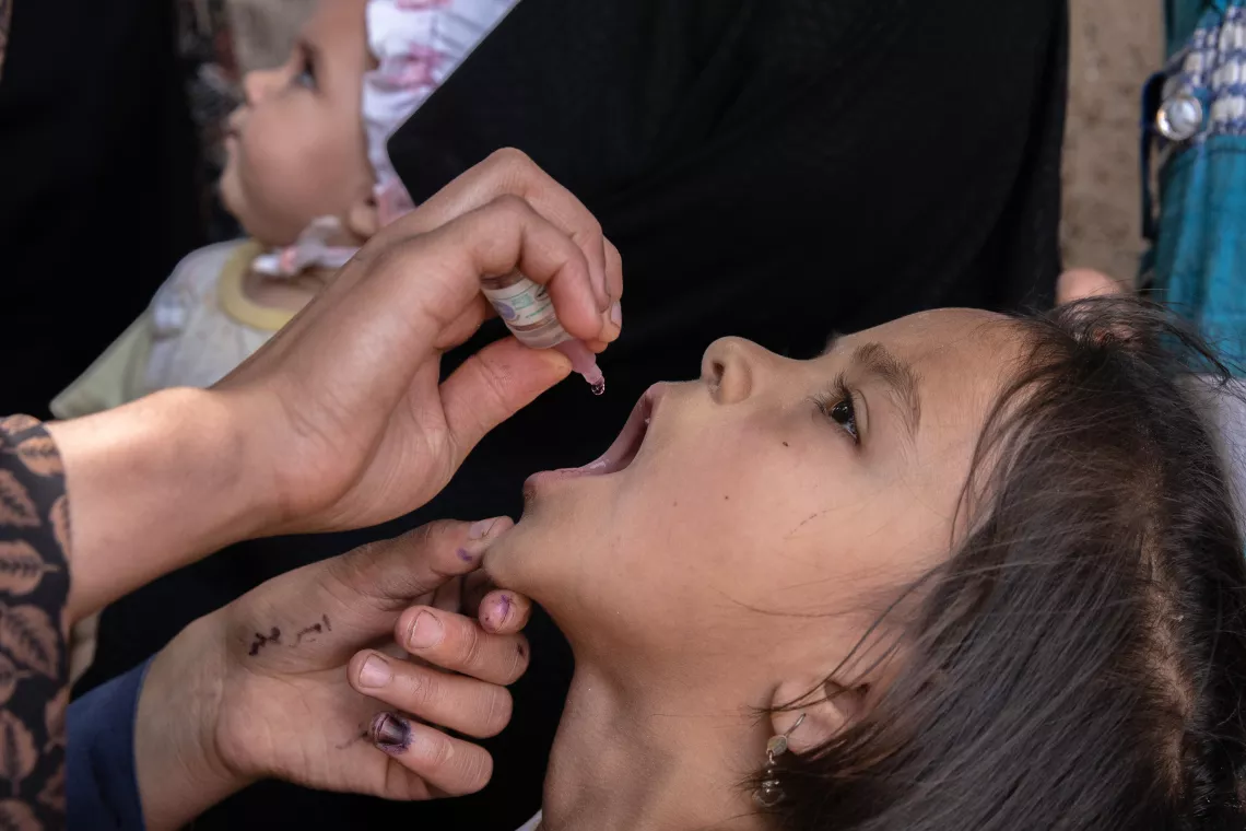 A girl with her head tilted back receives a vaccination against polio outside her home. 