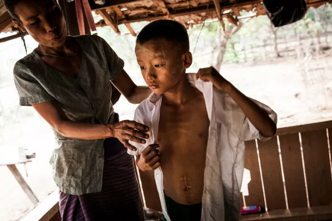 Min Thiya, 10, (right) is helped with his shirt after showing a large scar from injuries he sustained two-years ago when he and a group of his friends were playing with unexploded ordnance that killed his friend So Aung Myo Win instantly and injured four others, including Min, at the Ann Ka Law village in Kayin State in Myanmar, Monday 3 April 2017.