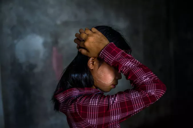 Naw Nee, a 14-year-old from the Bago region, bears the lasting scars of a tragic landmine explosion. The incident, which claimed the life of her brother, occurred when he unknowingly picked up a landmine, mistaking it for a toy, while playing just outside their home.