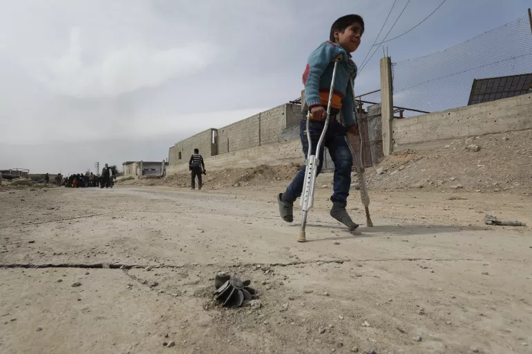 في 15 مارس 2018، الغوطة الشرقية. صبي يمشي على عكازات باتجاه الحمورية حيث تم فتح مخرج الإخلاء من الغوطة الشرقية.