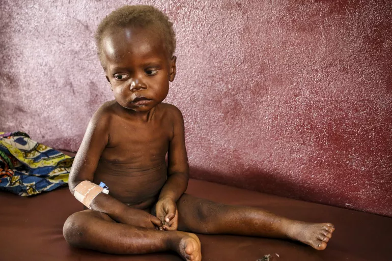 On 20 July 2018 in the Central African Republic, Pierre Mbassissi in bed at the malnutrition stabilisation centre at the Bangui Paediatric hospital.