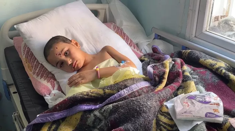 FILE Photo, 9-year-old Jouri in the European Hospital, Khan Younis, Gaza on 9 April 2024. The bones in Jouri&rsquo;s right arm, wrist and the right side of her face had several breaks, likely requiring further surgery. She had serious open wounds that were yet to receive reconstructive surgery &ndash; the hospital was not able to do this so was forced to focus on keeping the wound clean.  