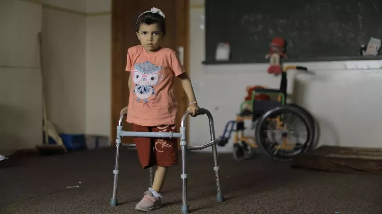 A young girl lost her right leg after her house was bombed in Gaza city.