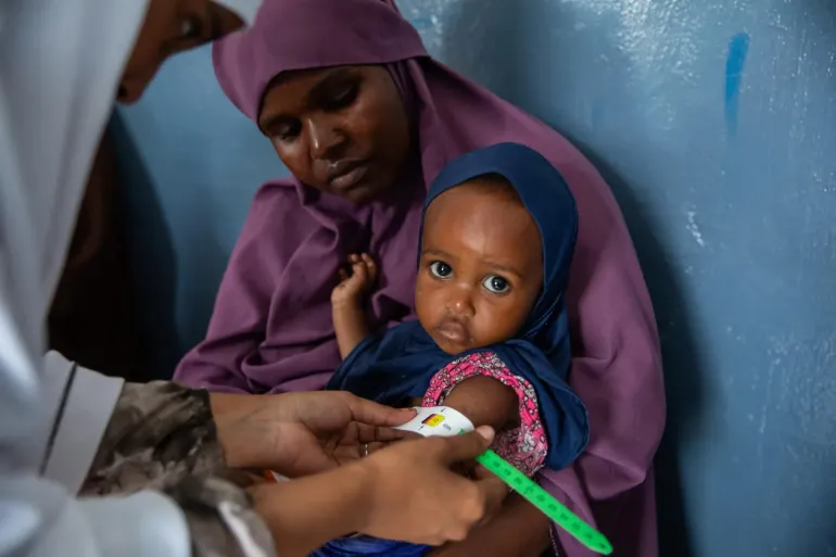 Health workers measure the mid-upper arm circumference of Maida Abdullahi, 18 months old, as her mother Qamar Isak sits with her at Deyniile District Hospital in Mogadishu.