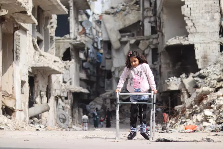 Eight-year-old Rama uses a walker to traverse her neighborhood in east Aleppo, Syria, where the scars of war mark every building behind her. . 