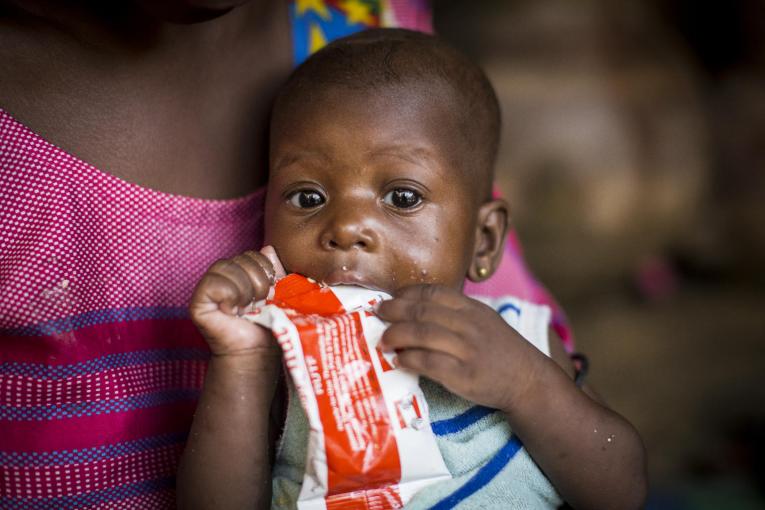 Niña con malnutrición en Mali