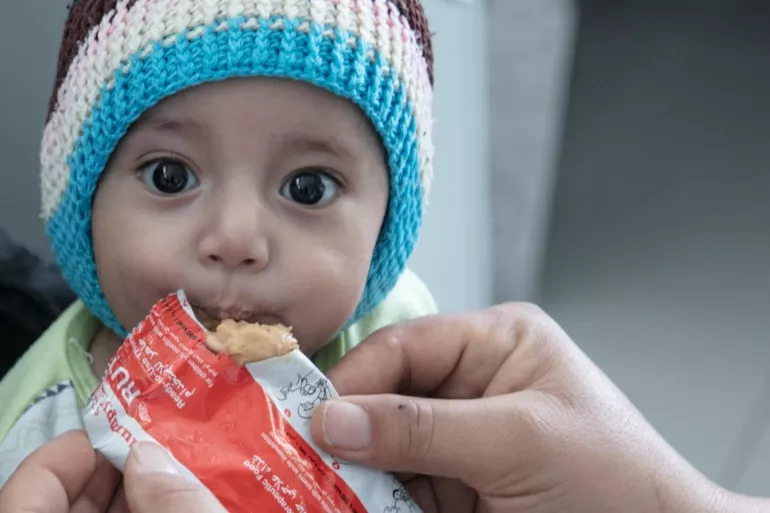 Yemen. A child receives a food supplement.