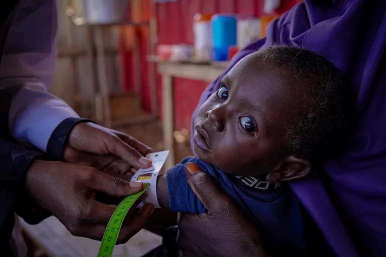 A young child is comforted by a caregiver during a MUAC nutrition screening, as drought continues to put children at greater risk of malnutrition. Early detection is critical to ensure timely referral and lifesaving treatment for the most vulnerable.