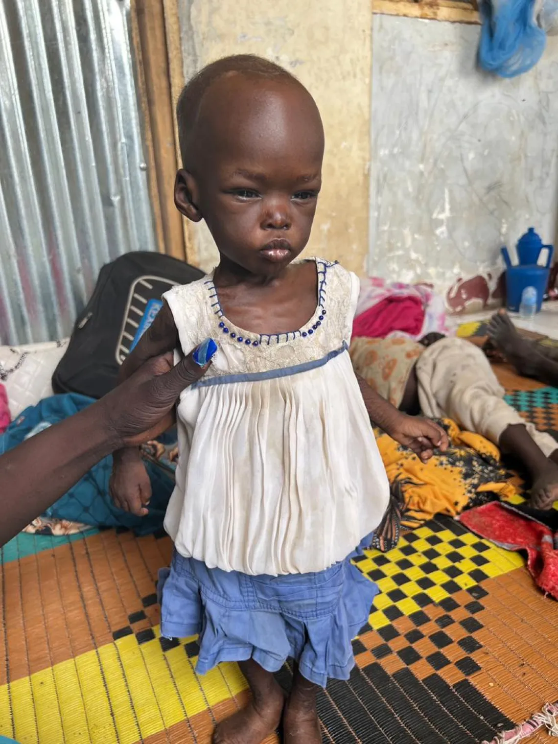 Baby Kamisa stands, held by her mother at the transit site, in Renk, South Sudan