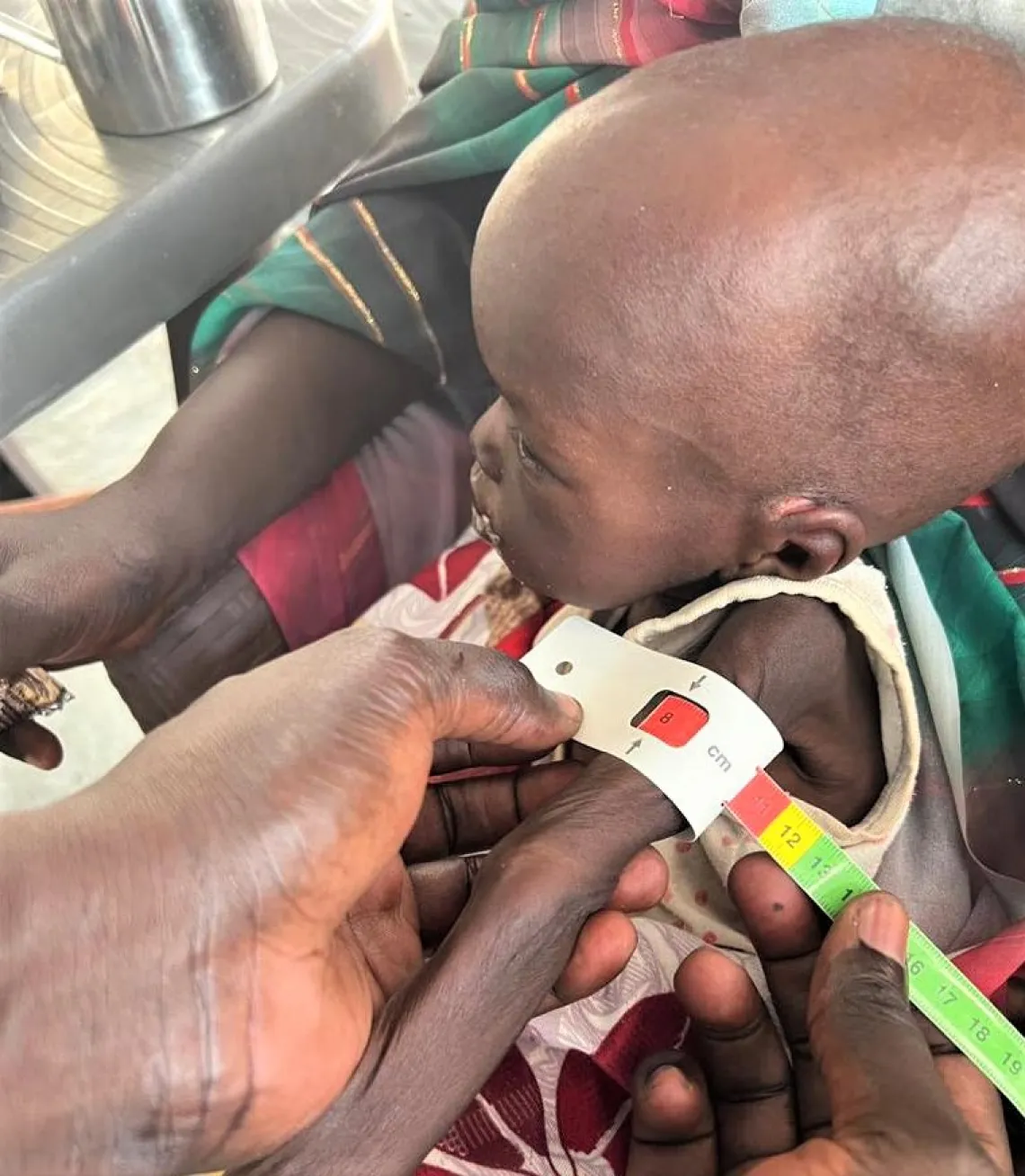 Kamisa screened for malnutrition at UNICEF transit site, Renk, South Sudan