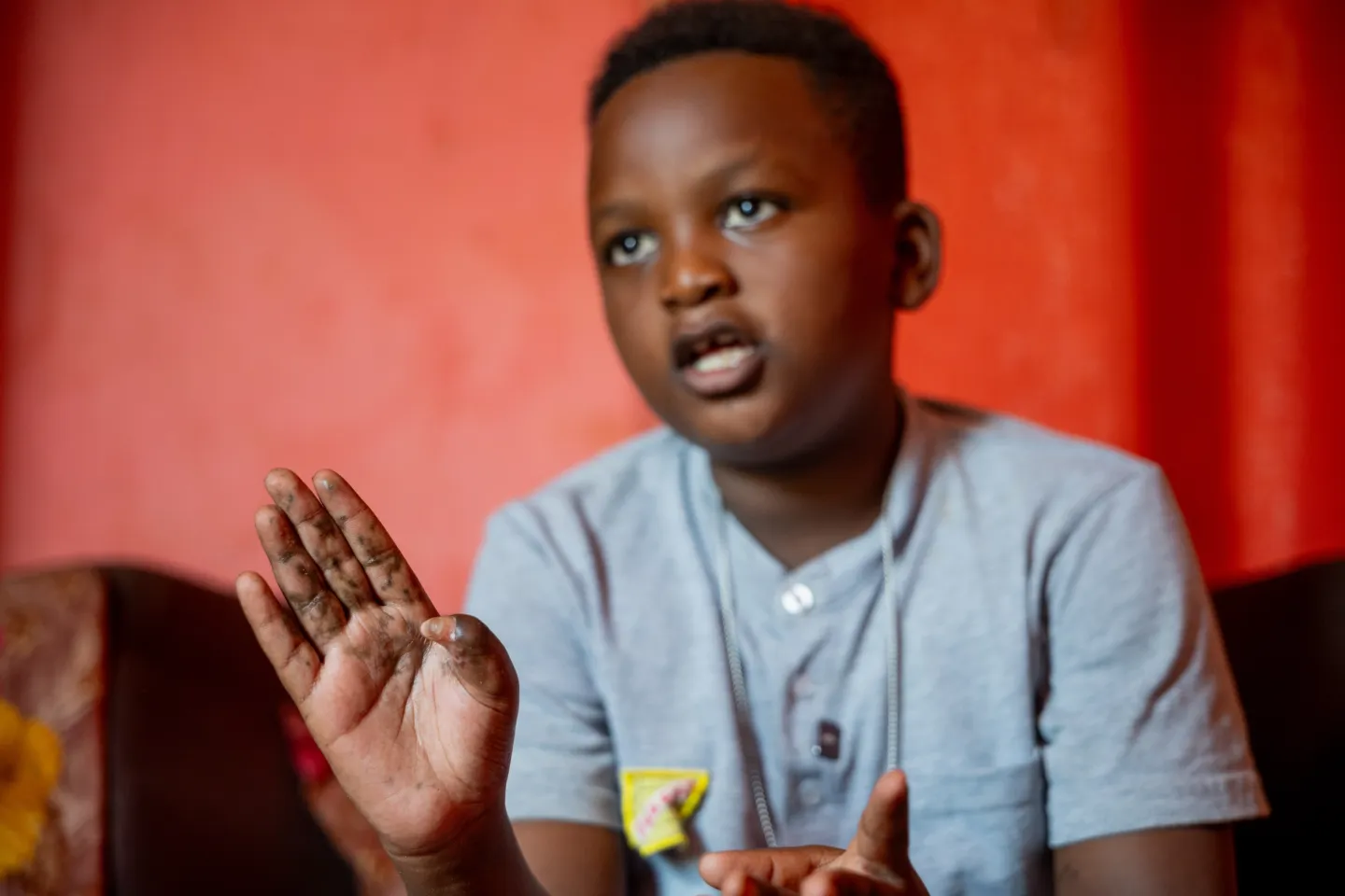 Boy speaking about an injury from an unexploded ordnance. 