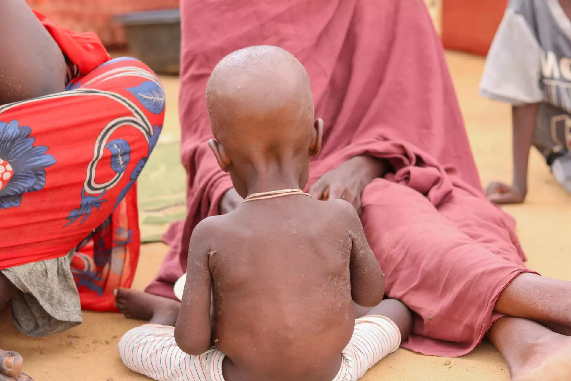 malnutrition, war, conflict, Al Fasher, Darfur, North Darfur, infant nutrition, famine, fighting