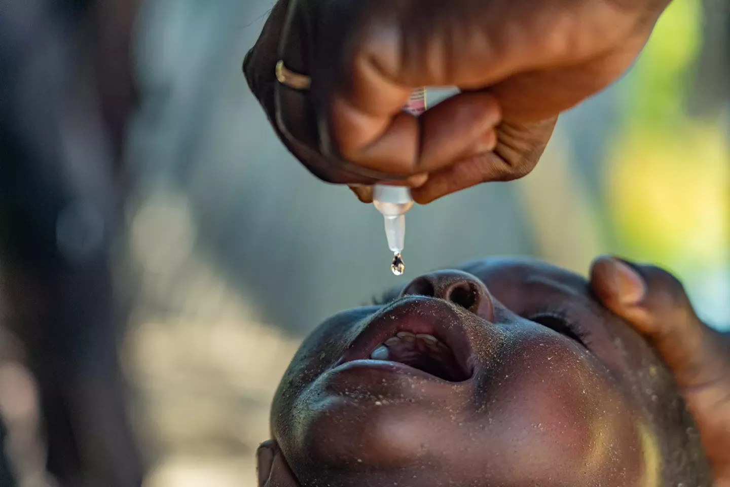 A child receives a Bivalent Oral Poliovirus Vaccine dose.