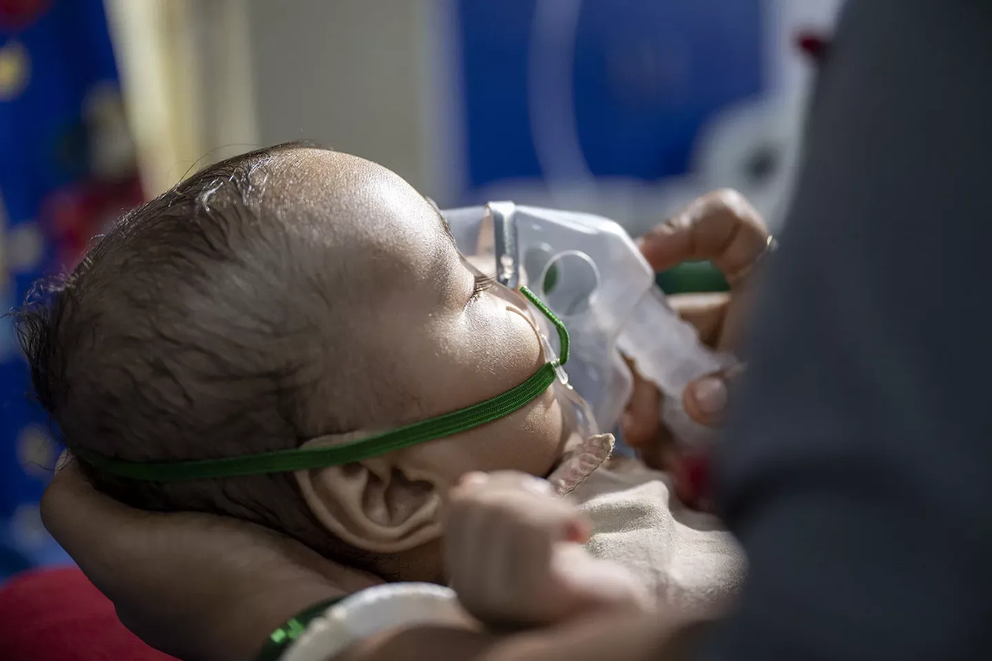 A baby with an oxygen support mask covering the child's nose and mouth. 