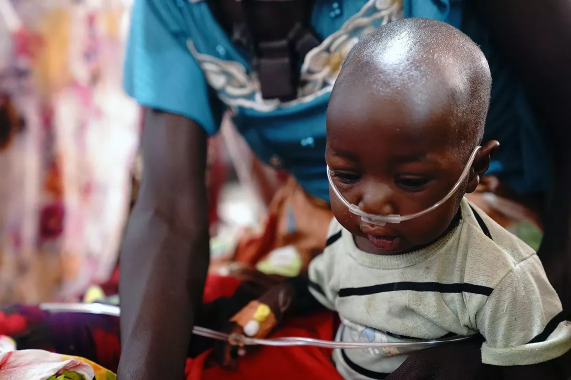A toddler with a breathing tube in his nose. 