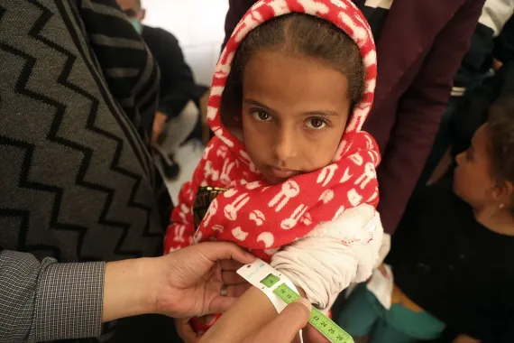 A girl has her arm measured with the child arm circumference by the MUAC tape.