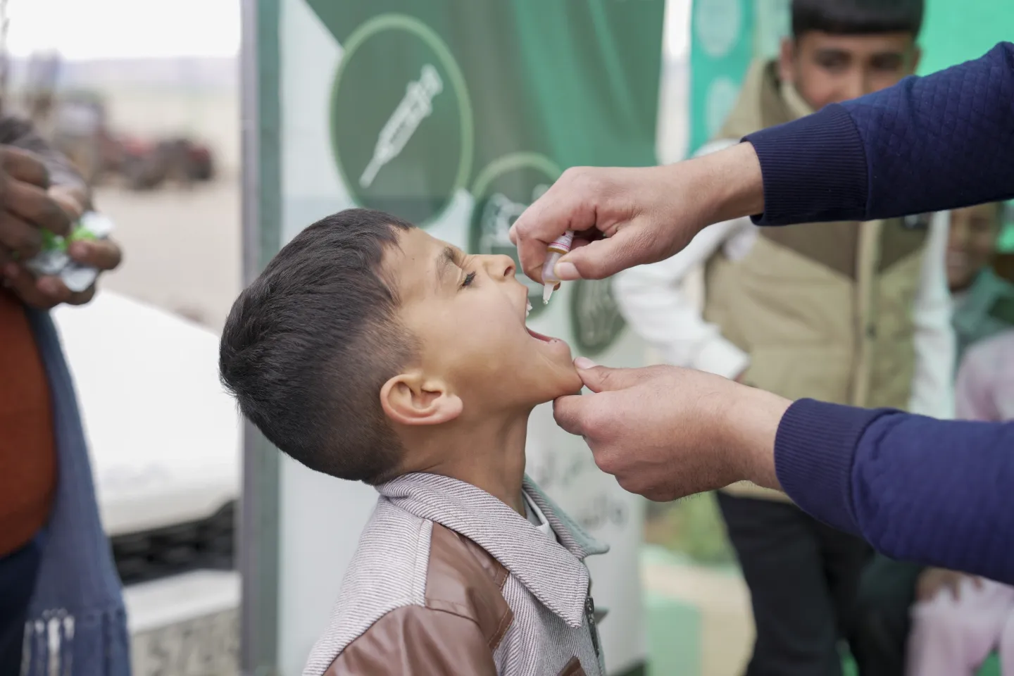 A little boy with his head tilted back, receives polio vaccine drops in his mouth.