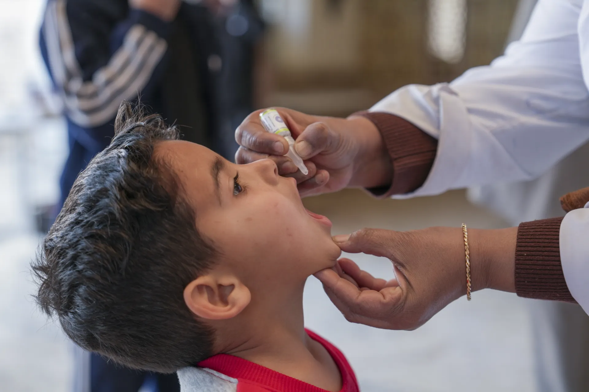 A little boy wearing a red t-shirt holds his head tilted back to receive oral vaccination drops.