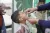 A little boy with his head tilted back, receives polio vaccine drops in his mouth.