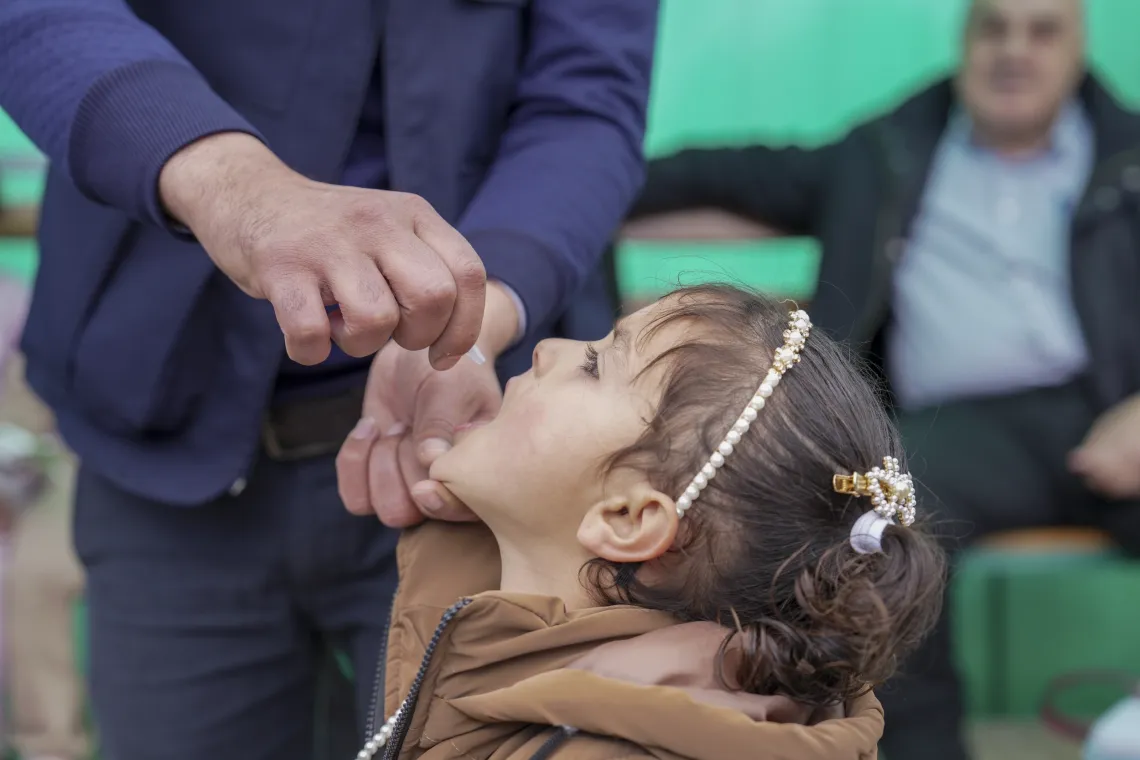 A little girl with her titled back, receives polio vaccine drops in her mouth.