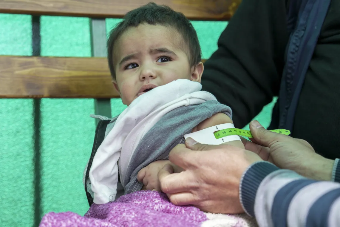 An infant boy looks up while his upper-arm circumference is measured to estanblish his nutritional status.