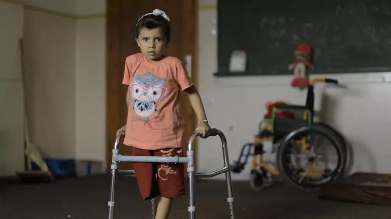 A young girl lost her right leg after her house was bombed in Gaza city.