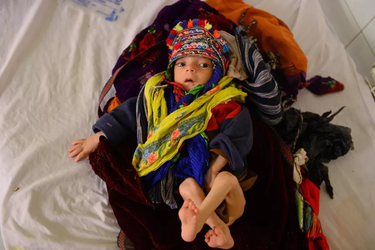 &Ouml;nlenebilir bir hastalık olan zat&uuml;rre başka herhangi bir hastalığa g&ouml;re daha fazla sayıda &ccedil;ocuk &ouml;l&uuml;m&uuml;ne neden oluyor