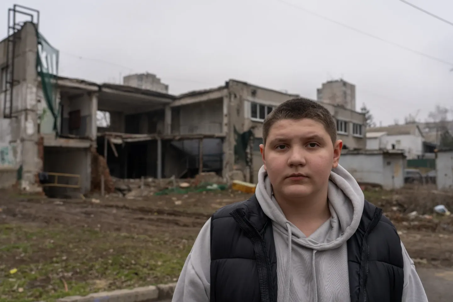  12-річний Захар із прифронтового села на Харківщині, який постраждав унаслідок вибуху гранати. 