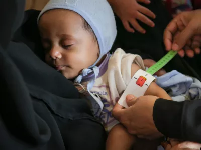 Salim, de 7 meses de edad, est&aacute; siendo evaluado, a trav&eacute;s de la medici&oacute;n de la circunferencia del brazo, para verificar la desnutrici&oacute;n