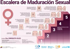 Escalera de Maduraci&oacute;n Sexual Femenino