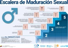 Escalera de Maduraci&oacute;n Sexual Masculino