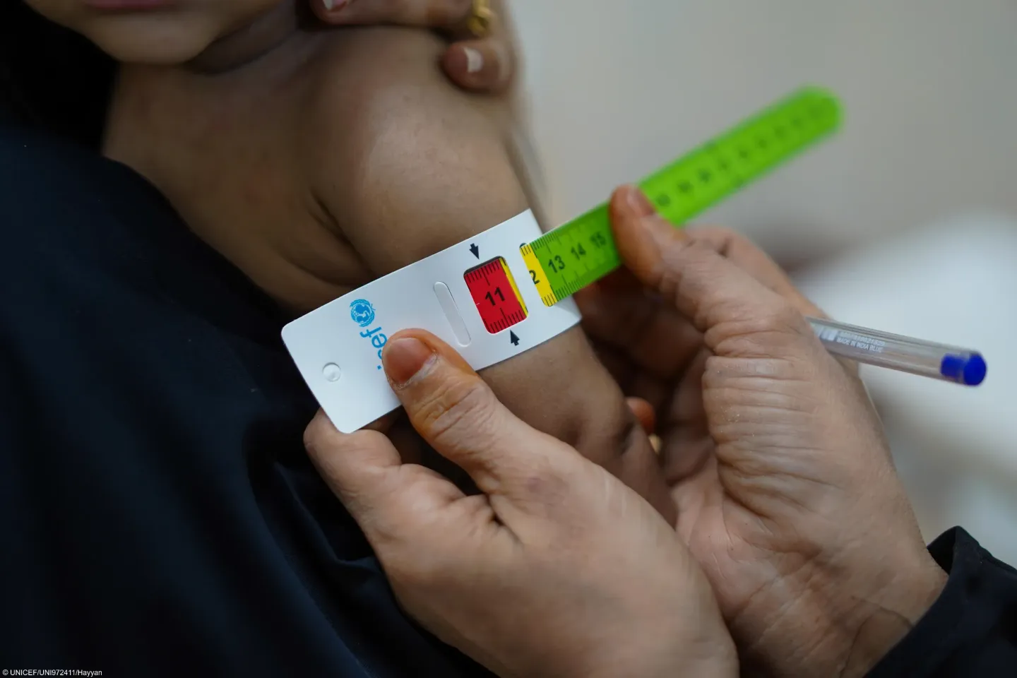 A baby having medical check-up with his mother