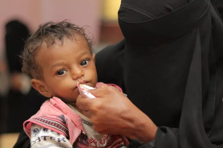 Shawqi Fahd, one year old, in the hands of his mother in the Maternal and Childhood Center in Zingibar, Abyan